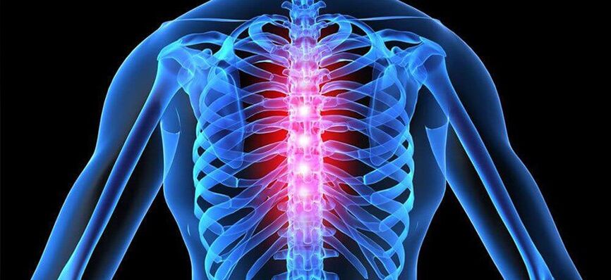 Ostry ból jest charakterystyczny dla zaostrzenia osteochondrozy kręgosłupa piersiowego