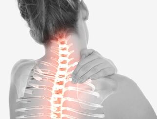 Osteochondroza obszaru szyjki macicy