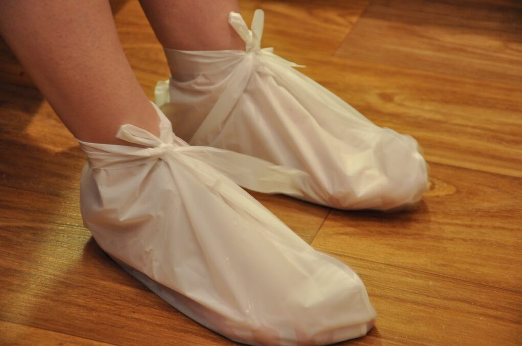 okłady na artrozę stawu skokowego