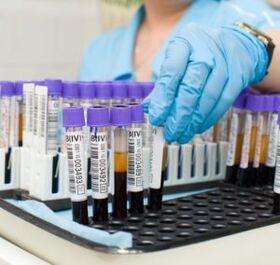 badanie krwi w celu zdiagnozowania bólu stawów