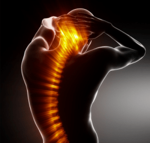 osteochondroza to choroba kręgosłupa